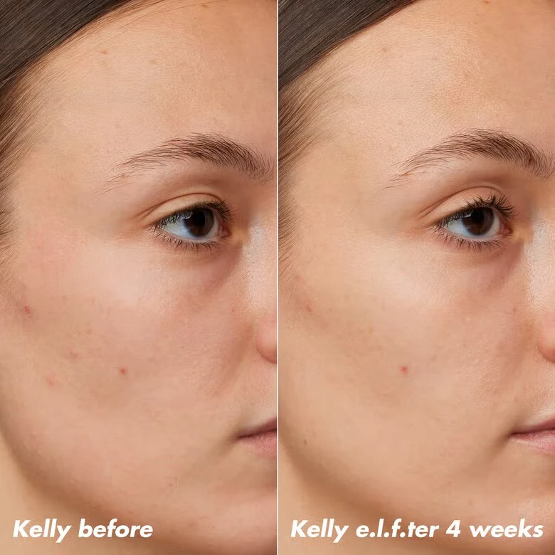 Plz Clarify Facial Oil - Image 5